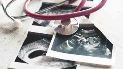 Ultraschallbilder einer Schwangerschaft